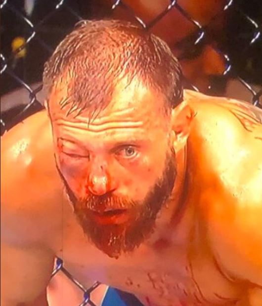 Tony Ferguson phán muốn tái đấu với Donald Cerrone vì thắng kiểu này không vui Tony Ferguson phán muốn tái đấu với Donald Cerrone vì thắng kiểu này không vui